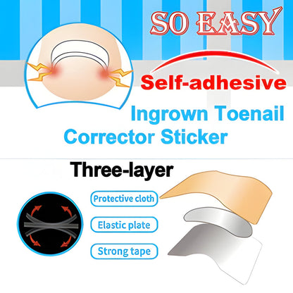 Quick Nail Repair Patches For Strong Nails