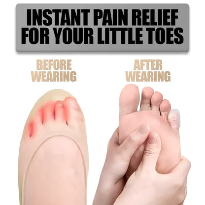 Soft Gel Toe Guard Protectors