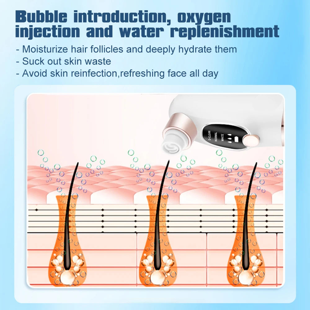 Mini Facial Pore Cleaner and Blackhead Extractor