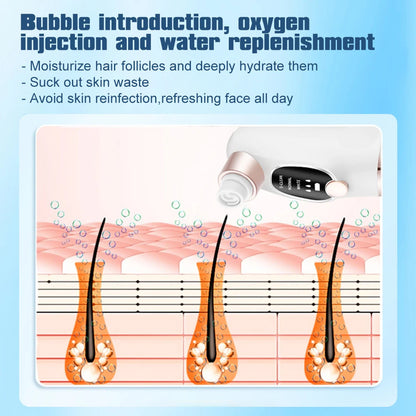 Mini Facial Pore Cleaner and Blackhead Extractor
