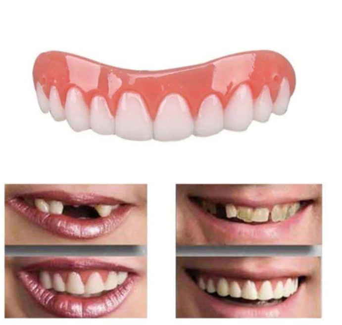 Natural Looking Dental Veneers for Perfect Teeth