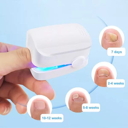 Effective Toenail Fungus Removal Laser Tool