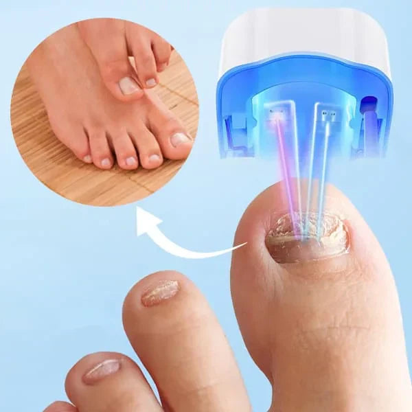 Effective Toenail Fungus Removal Laser Tool