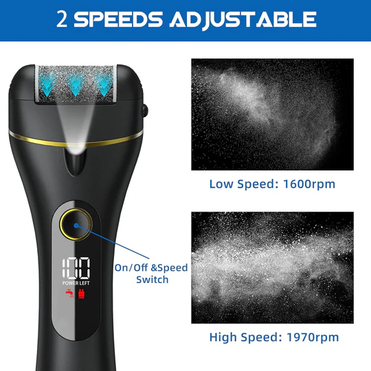 Fast Callus Removal Tool