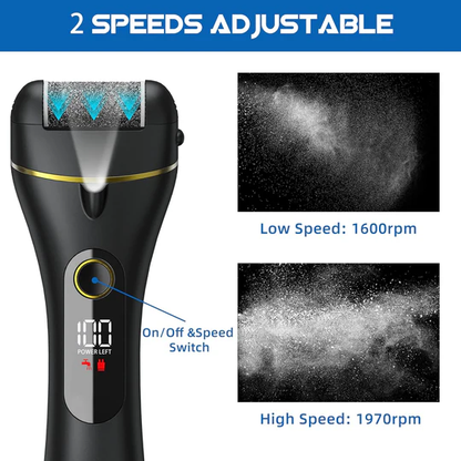 Fast Callus Removal Tool