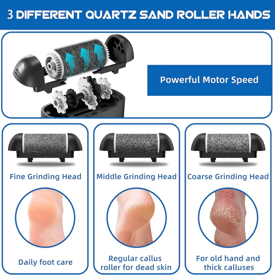 Fast Callus Removal Tool