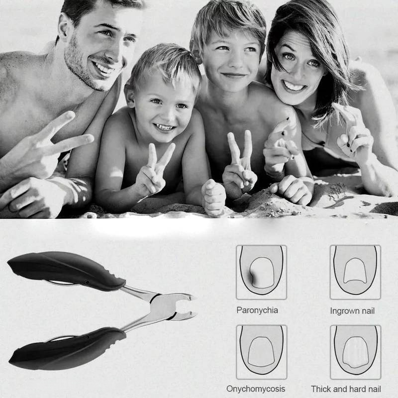 Easy Grip Toenail Clipper for Thick Nails