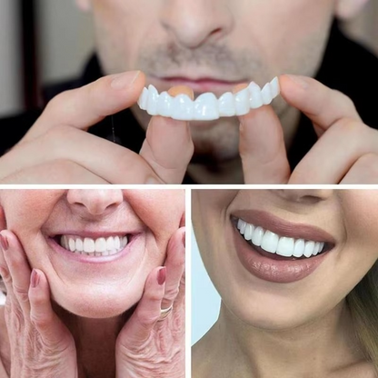 Easy Fit Temporary Dental Veneers for Men Women Smile