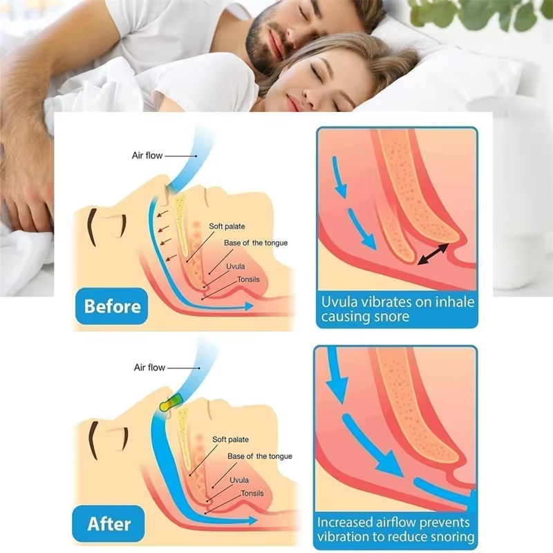 Sleep Aid Nose Clip for Easy Breathing and Restful Sleep