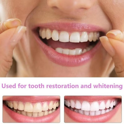 Easy Fit Temporary Dental Veneers for Men Women Smile