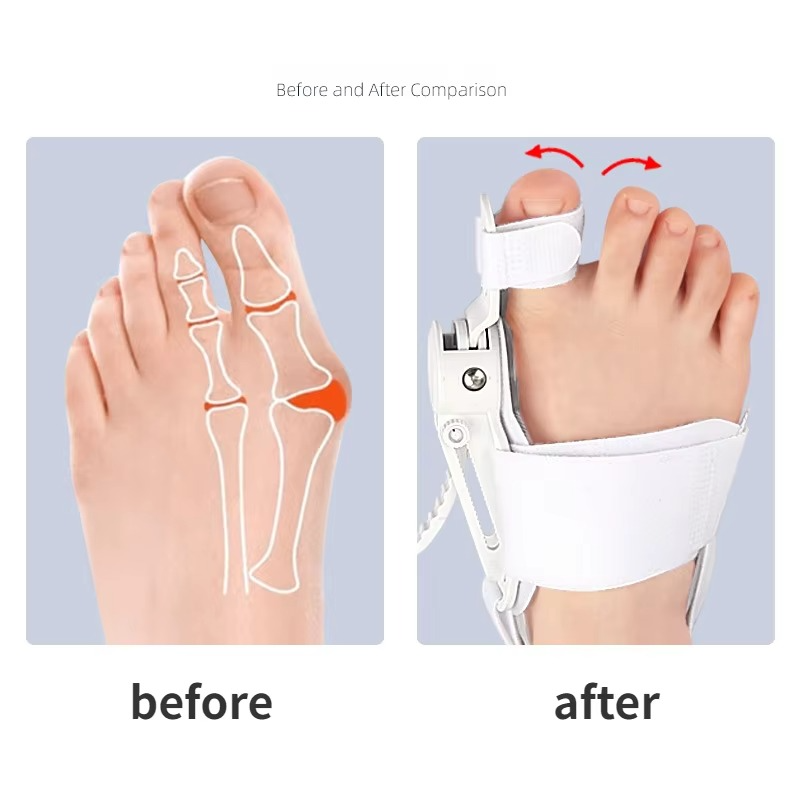 Soft Toe Spacer Gel Support Sleeve
