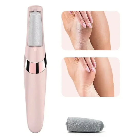 Fast Foot Callus Removal Tool - Hehif