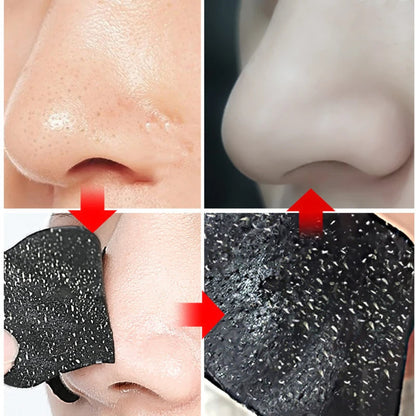 Effective Blackhead Removal Nose Strips