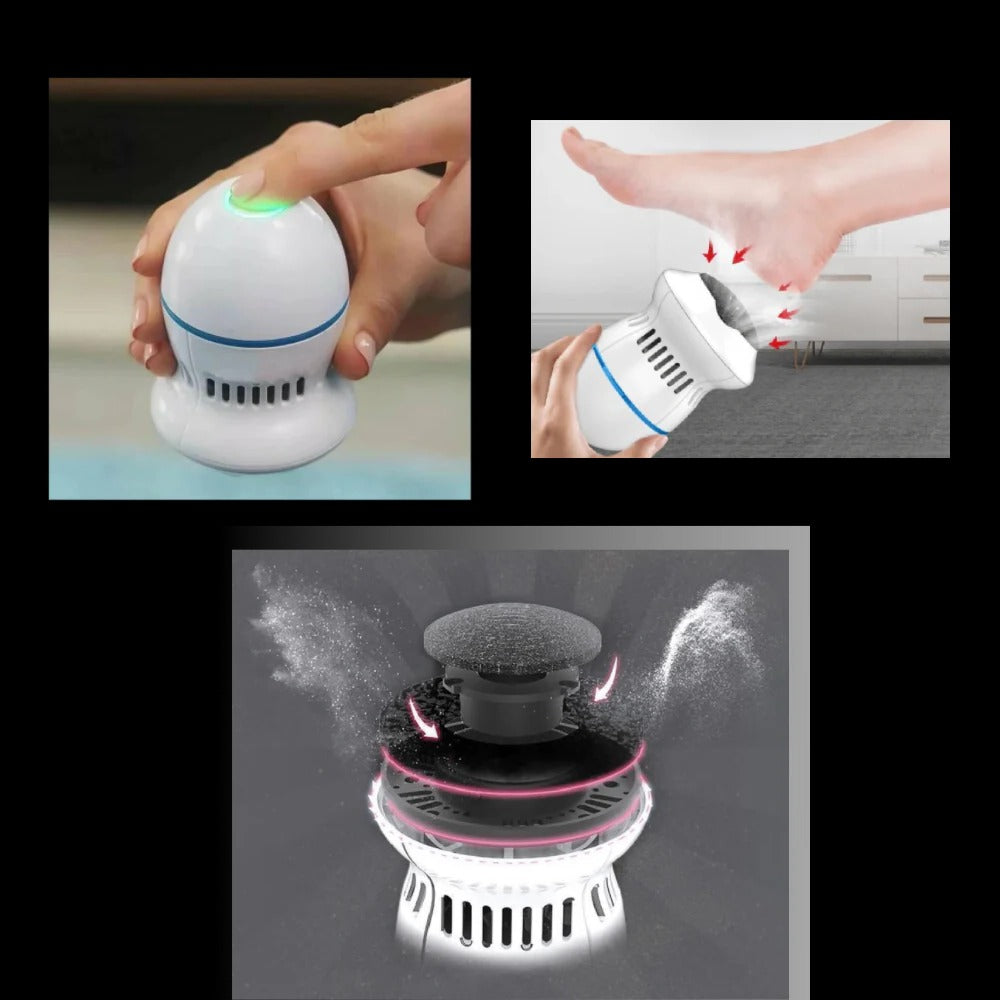 Easy Foot Callus Shaver