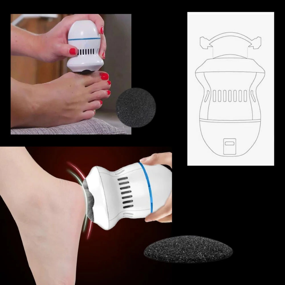 Easy Foot Callus Shaver