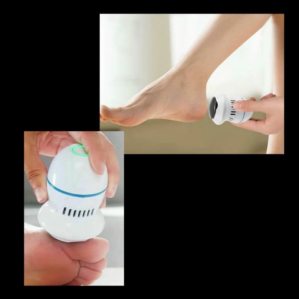 Easy Foot Callus Shaver