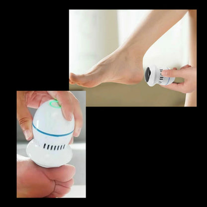 Easy Foot Callus Shaver