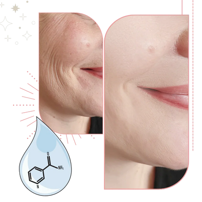 Anti Aging Moisturizing Face Cream