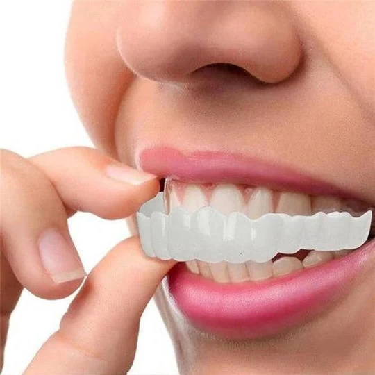 Complete Teeth Veneer Kit Upper Lower Set