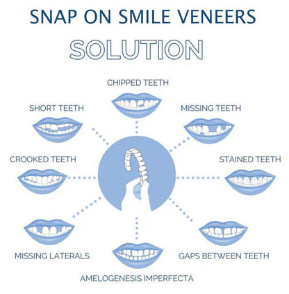 Complete Teeth Veneer Kit Upper Lower Set
