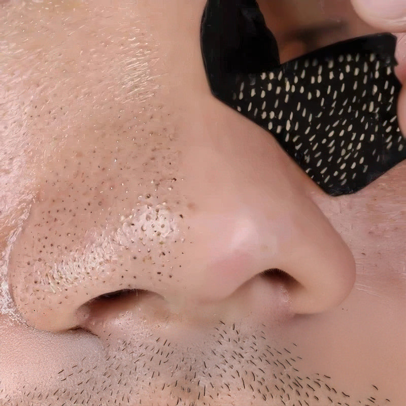 Effective Blackhead Removal Nose Strips - Hehif